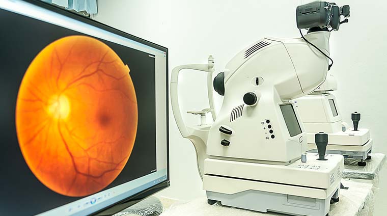 Three eye care professionals pose for a photo